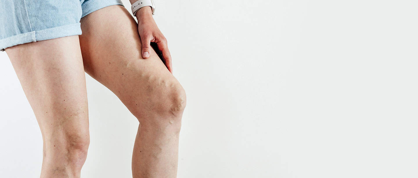The Vein Center