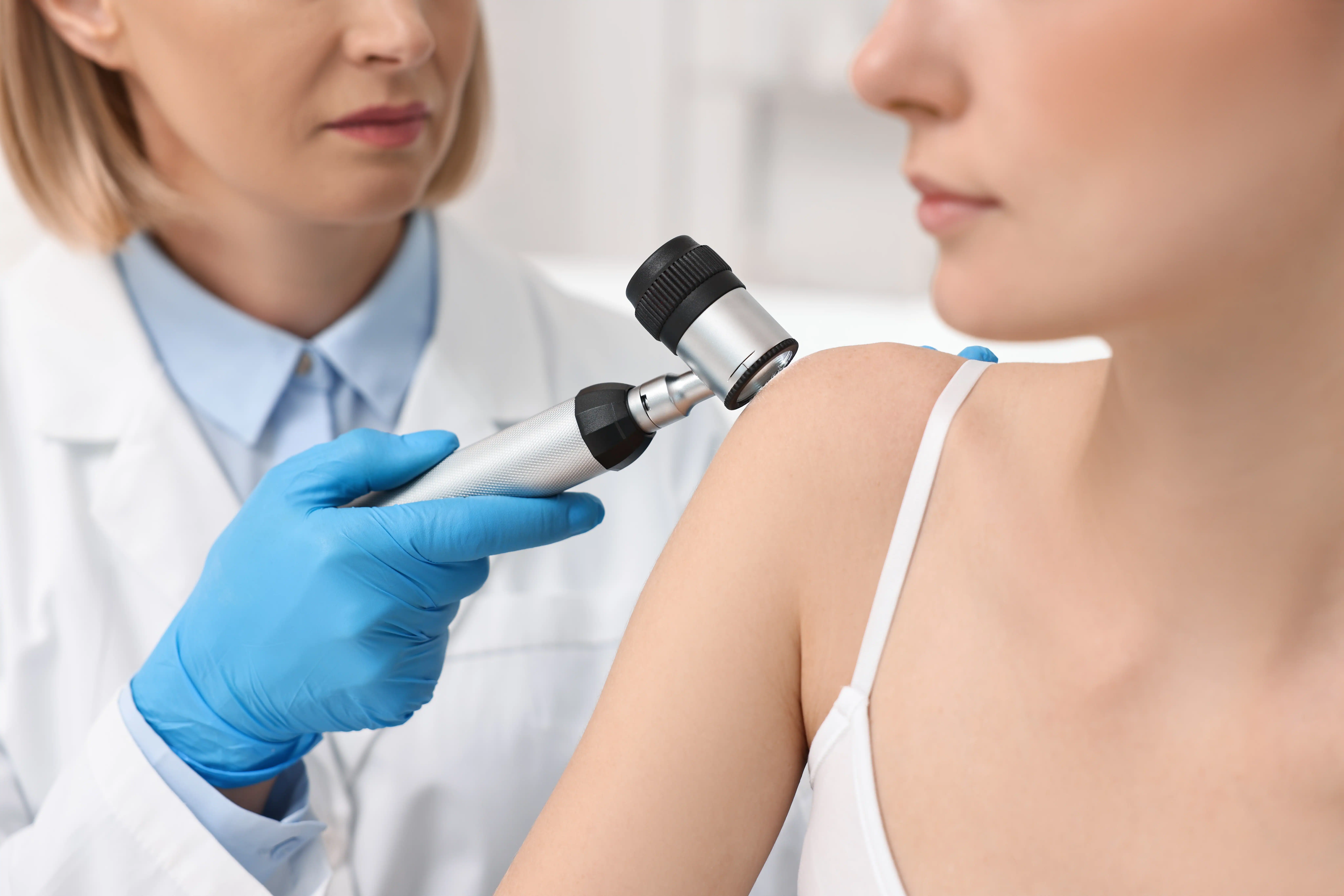 Dermatologist conducting a skin cancer check on a woman