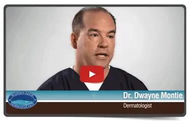 Tinea Versicolor: Dr. Dwayne Montie