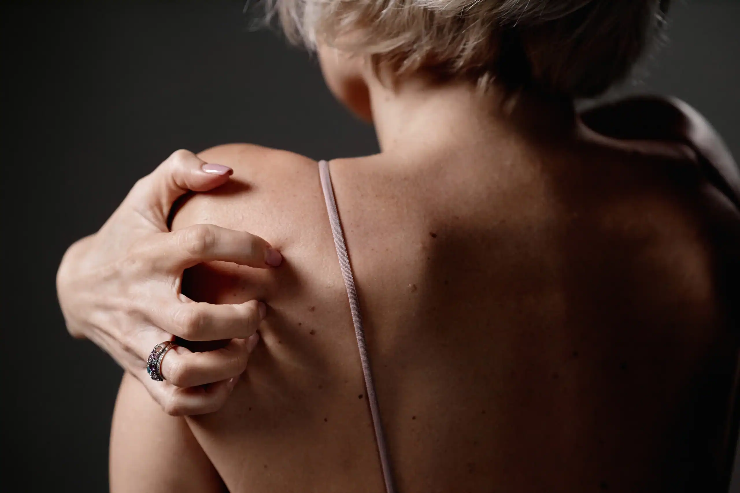 woman scratches an itch on her back