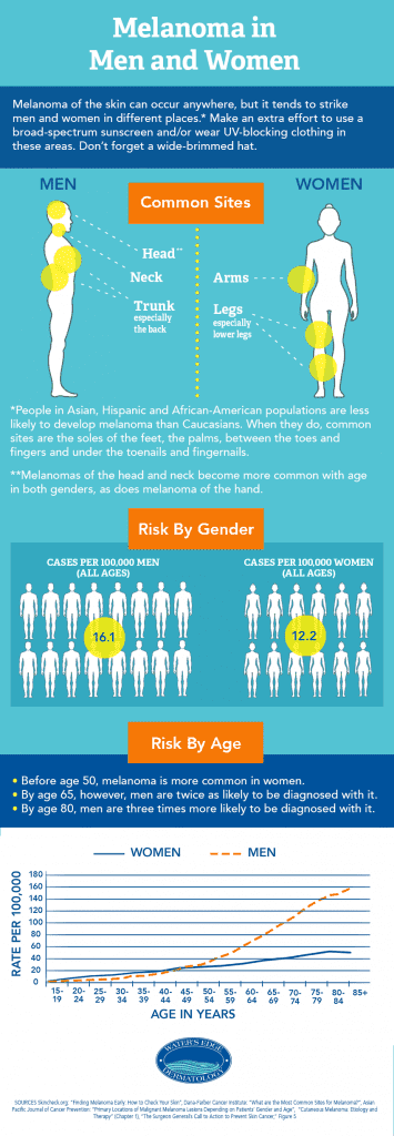 Infographic most common sites for melanoma in men vs. women