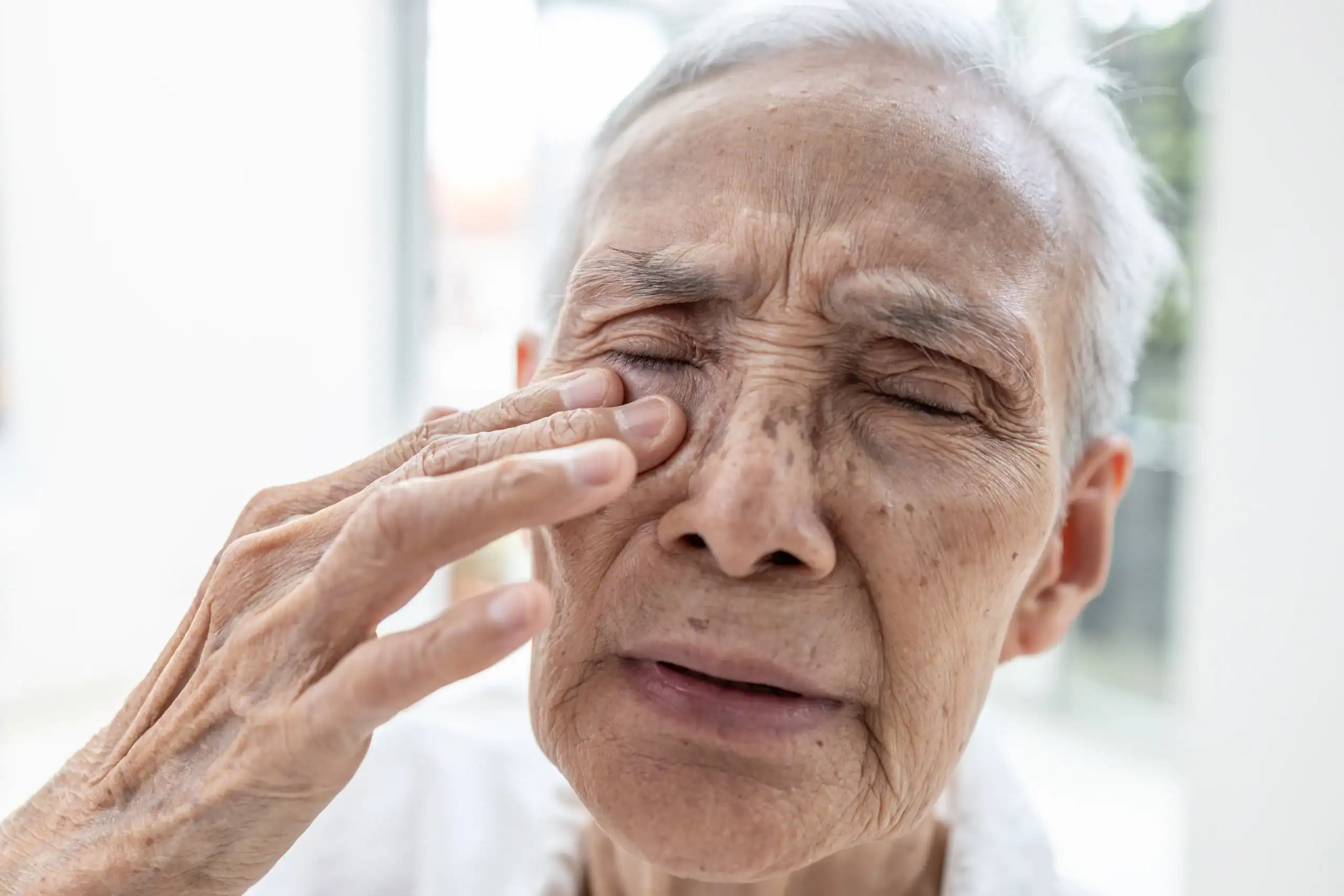 Senior woman with eyelid irritation