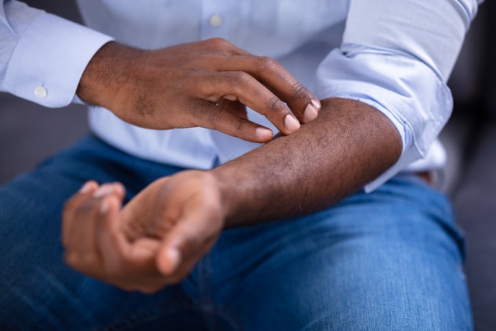 Why Diabetes Can Cause Dry Itchy Skin Water S Edge Dermatology Why Diabetes Can Cause Dry Itchy Skin Water S Edge Dermatology