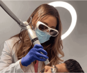 Surface laser therapy for spider veins on the face