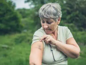 Senior woman with bruise on her arm