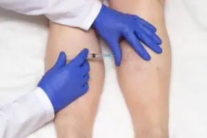 Woman undergoing sclerotherapy for spider veins