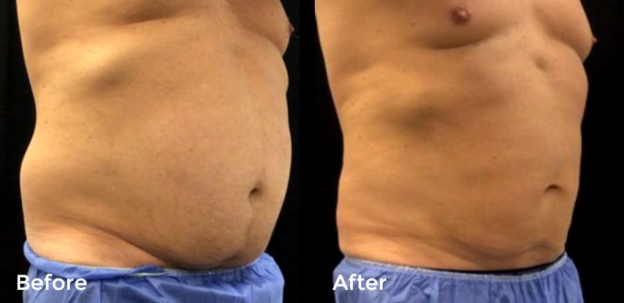 Cool Event Before and After Image #1