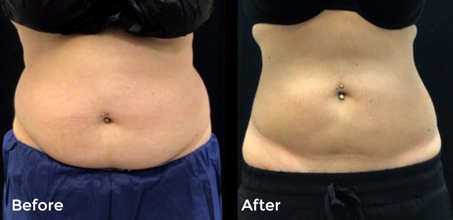 Cool Event Before and After Image #2