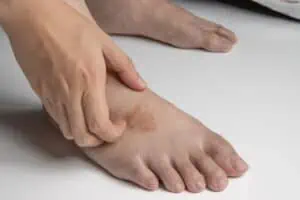 Ringworm on the top of the foot