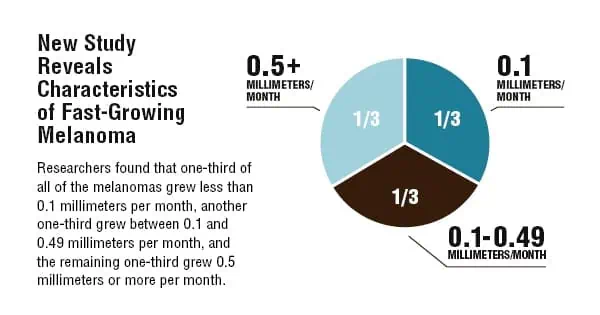Infographic about new study of melanoma