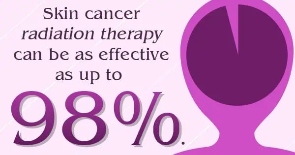 Infographic about how skin cancer radiation therapy can be as effective up to 98%