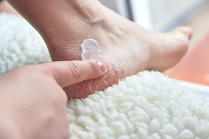 Person applying skin cream to heel.