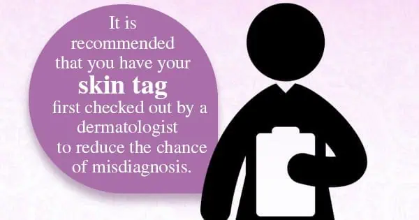 Infographic about skin tags