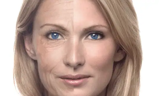 Picture of woman's face with half in wrinkles and the other half with clear smooth skin