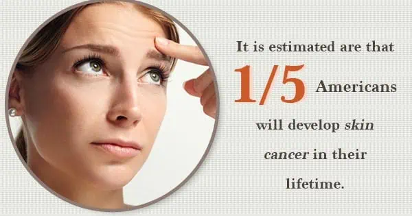Infographic declaring that 1 in 5 Americans will develop skin cancer in their lifetimes.