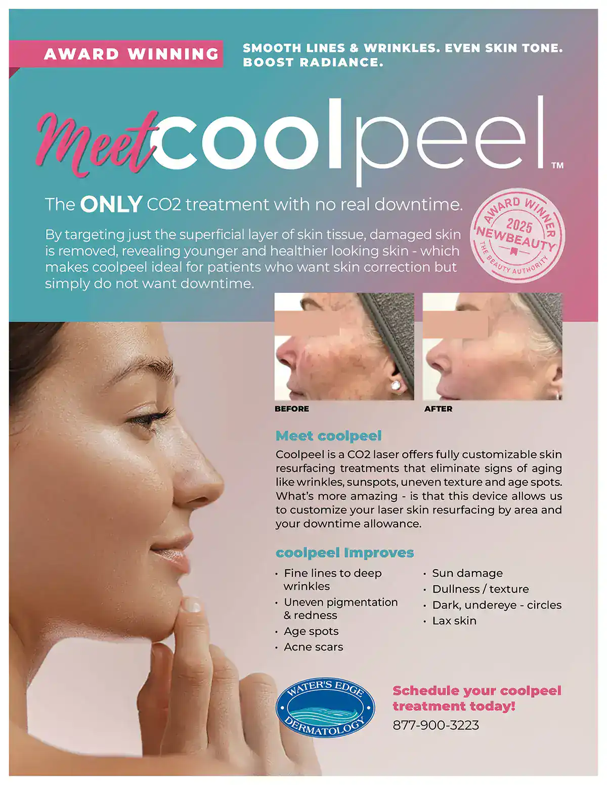 Promotion for CoolPeel at Water's Edge Dermatology