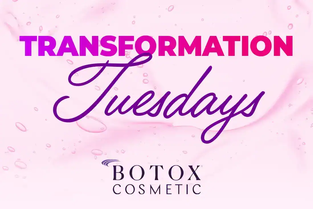 Transformation-Tuesdays