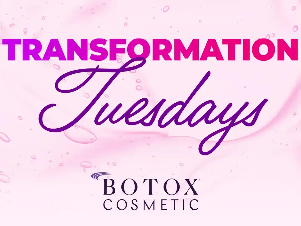 Transformation-Tuesdays