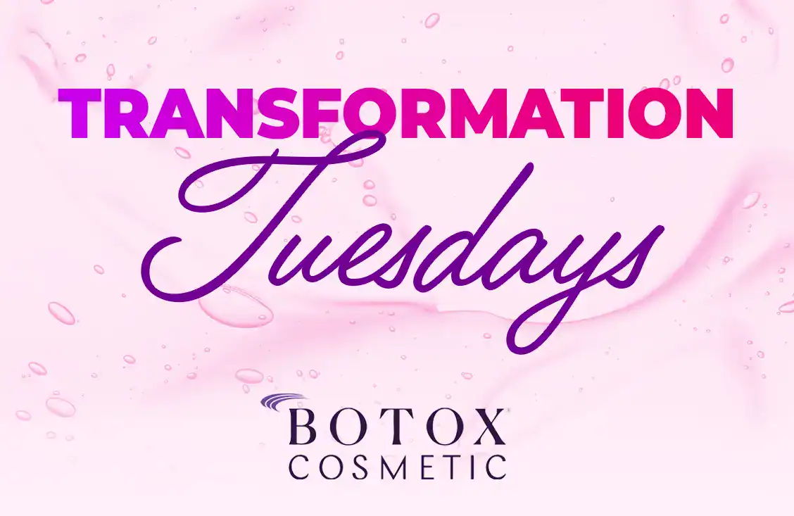 Transformation-Tuesdays